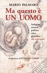 Ma questo è un uomo. Indagine storica, politica, etica, giuridica sul concepito Must-Have
