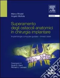 Saldi Superamento degli ostacoli anatomici in chirurgia implantare. Implantologia computer-guidata innesti ossei. Con DVD