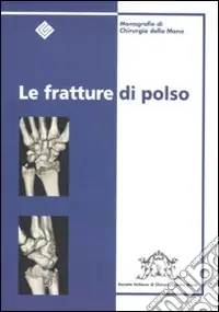 Le fratture di polso Solo Oggi