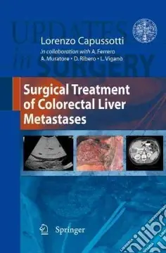 Surgical treatment of colorectal liver metastases Prezzo Ridotto