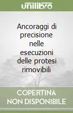 Non Perdere Ancoraggi di precisione nelle esecuzioni delle protesi rimovibili