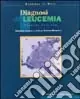 Diagnosi di leucemia A Buon Prezzo