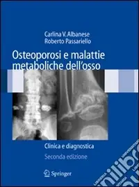 Offerta Limitata Osteoporosi e malattie metaboliche dell‘osso. Clinica e diagnostica