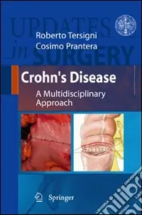 Crohn‘s disease. A multidisciplinary approach series. Updates in surgery Prezzo Scontato
