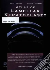 Saldi Atlas of lamellar keratoplasty. Con DVD
