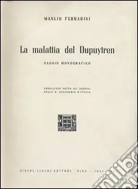 La malattia del Dupuytren Sconto